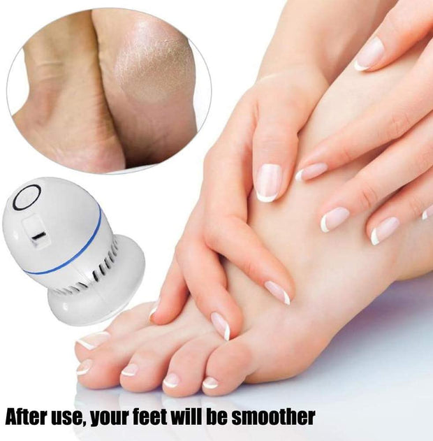 This Electric Foot File Is Here To Save Your Feet